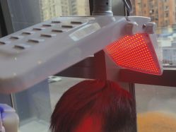 -碧莲盛·不剃发植发