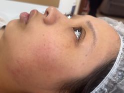 -长沙雅美医疗美容医院