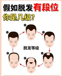 -唐风采假发补发定制
