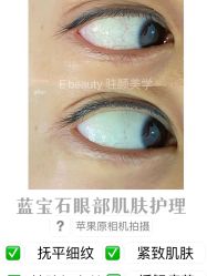 -E.beauty驻颜·痘敏肌调理中心