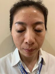 -北京米扬丽格医疗美容·联合丽格鼻整形中心