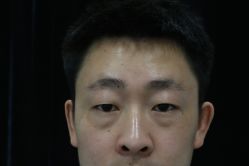-Yestar宁波艺星整形医院