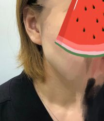 -More摩尔医美の注射线雕光电中心