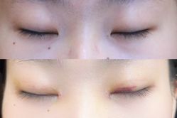 -Yestar 嘉兴艺星医疗美容医院