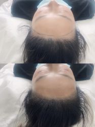 -西施无菌半永久纹绣眉眼影唇轻增发纹发际线