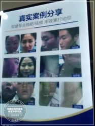 -成都军建医院·疤痕诊疗中心