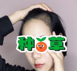 -大麦微针植发丨全国连锁