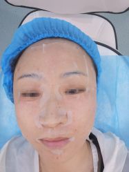 体验后-瑞鑫创美·高定轻医美