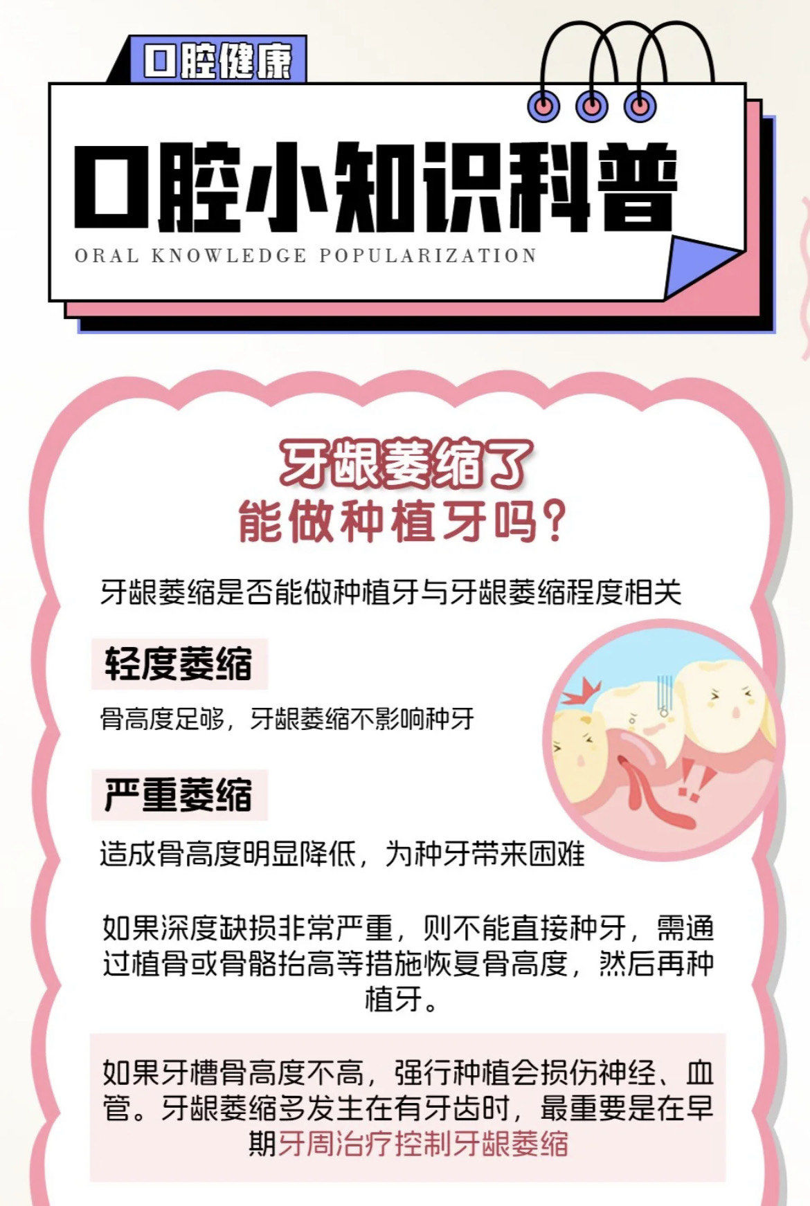 口腔科普