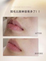 点击看大图 -植蔻妍倍儿专业脱毛·皮肤管理