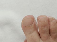 -新甲连锁灰指甲·甲沟炎·鸡眼(黑龙江路店)