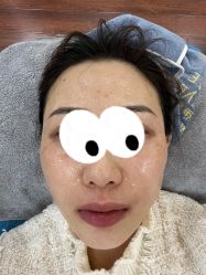 体验前-沈阳名流美容医院