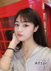 -小忠丽格医美
