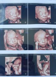 -杭州贝瑞斯美华妇儿医院·早孕·产检·儿科