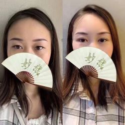 -郡艺医疗美容·微整·眼鼻吸脂