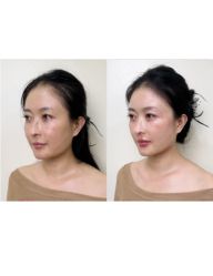 -上海伊莱美医疗美容医院