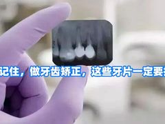 -团圆口腔·种植中心(锦江院区)