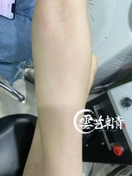 -雲艺刺青·洗纹身