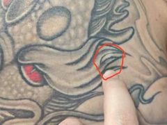 -上海市杨浦区中医医院