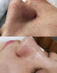 -苗方清颜痘肌研究所