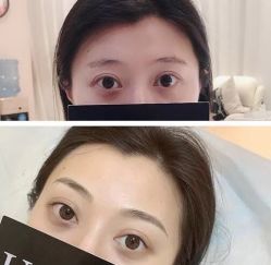 -UP&UP·半永久眉毛眼线机器野生眉