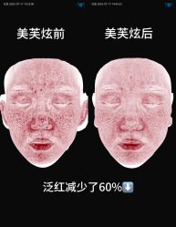 -AURAS璈然科技护肤中心