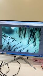 -碧莲盛·不剃发植发