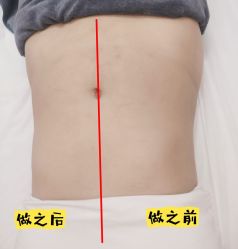 点击看大图 -Lily纤美·科技减脂中心