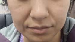 -杭州奥拉克医疗美容门诊部