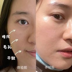 点击看大图 体验前-北京爱育华医院-医疗美容科