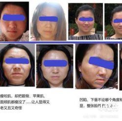 体验后-上海玫瑰医疗美容医院