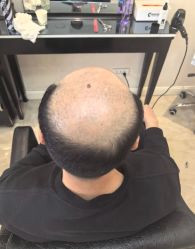 -唐风采假发补发定制