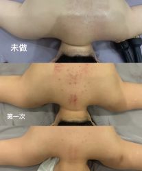 -Lily纤美·科技减脂中心