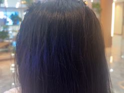 -碧莲盛·不剃发植发