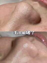 -SKIN79皮肤管理中心