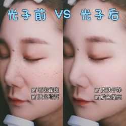 体验前-慕颜医疗美容·皮肤微整 抗衰