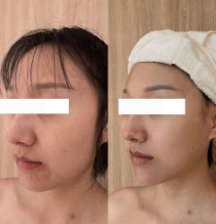 点击看大图 -AURAS璈然科技护肤中心
