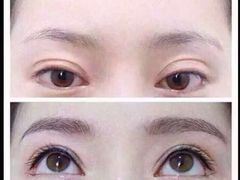 iphone_upload_pic-上海华安整形外科门诊部