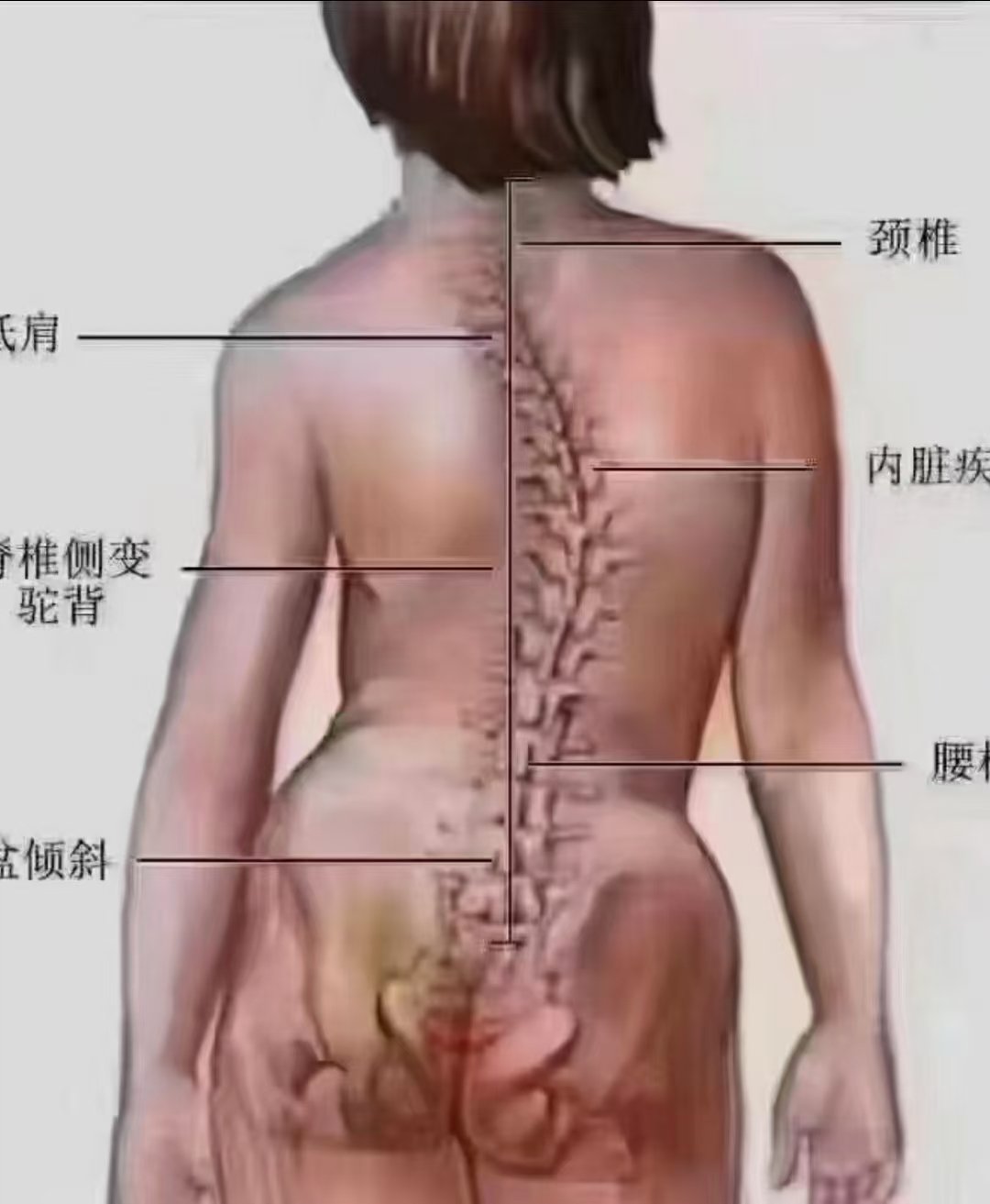 我们的脊柱就是我们的生命支柱