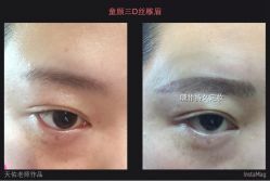 点击看大图 -光SPA科技美肤