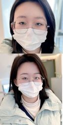 -Doris多里斯半永久纹眉·SMP纹发·发际线