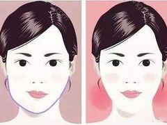 -团圆口腔·种植中心(锦江院区)