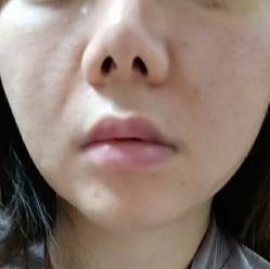 -素美医疗美容·西南眼鼻整形·修复基地