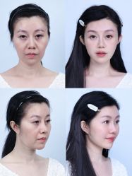 -深圳美莱医疗美容医院