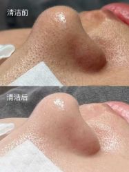 -禾壹净·素颜美问题肌肤修护中心