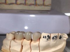 -上海仁爱医院口腔科 · 种植
