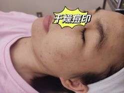 -恒妍医美·韩国定制抗衰中心