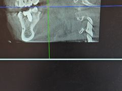 -土豆口腔(凤凰北总店)