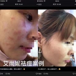 -艾尚妮·美容美体SPA