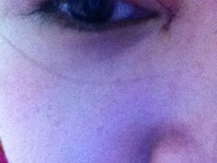 第一天-上海华安整形外科门诊部